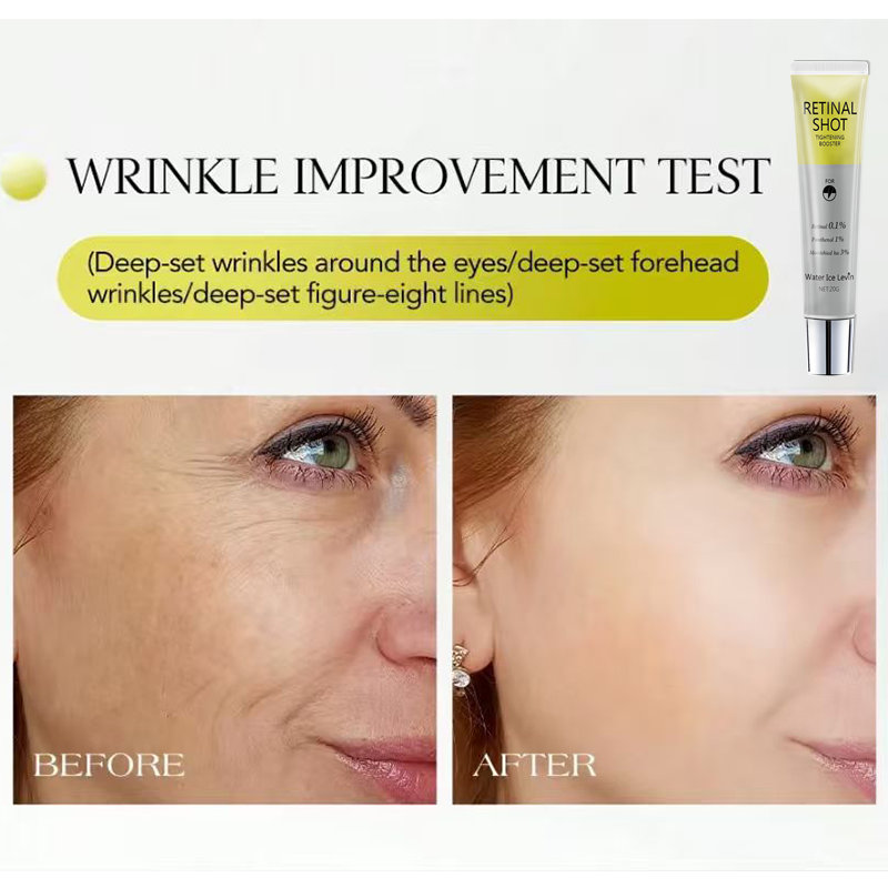 Retinal 0.1% Intensive Shot, P - The Ordinary Serum Hyaluronic Acid reseña y precio